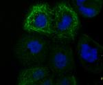 TYRP1 Antibody in Immunocytochemistry (ICC/IF)