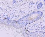 TYRP1 Antibody in Immunohistochemistry (Paraffin) (IHC (P))