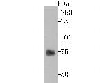 TYRP1 Antibody in Western Blot (WB)