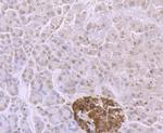 ADAR1 Antibody in Immunohistochemistry (Paraffin) (IHC (P))