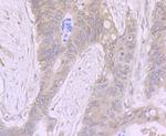 ADAR1 Antibody in Immunohistochemistry (Paraffin) (IHC (P))