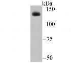 ADAR1 Antibody in Western Blot (WB)