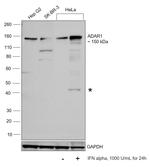 ADAR1 Antibody in Western Blot (WB)