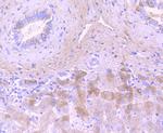 Complement C3 Antibody in Immunohistochemistry (Paraffin) (IHC (P))