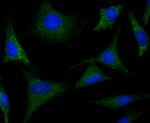 CRMP1 Antibody in Immunocytochemistry (ICC/IF)