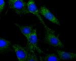 CRMP1 Antibody in Immunocytochemistry (ICC/IF)