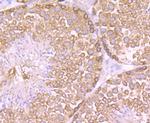 CAS Antibody in Immunohistochemistry (Paraffin) (IHC (P))