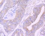 CAS Antibody in Immunohistochemistry (Paraffin) (IHC (P))