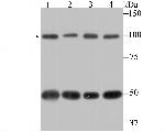 CAS Antibody in Western Blot (WB)