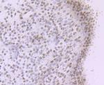 NR1D1 Antibody in Immunohistochemistry (Paraffin) (IHC (P))