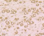 RPS19 Antibody in Immunohistochemistry (Paraffin) (IHC (P))