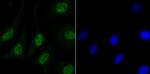 MATR3 Antibody in Immunocytochemistry (ICC/IF)