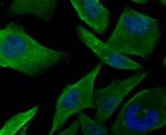 PFKM Antibody in Immunocytochemistry (ICC/IF)