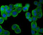 PFKM Antibody in Immunocytochemistry (ICC/IF)