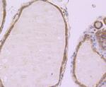 PFKM Antibody in Immunohistochemistry (Paraffin) (IHC (P))