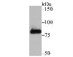 PFKM Antibody in Western Blot (WB)