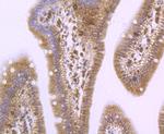 PSME1 Antibody in Immunohistochemistry (Paraffin) (IHC (P))