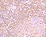 PSME1 Antibody in Immunohistochemistry (Paraffin) (IHC (P))