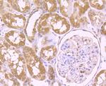 VPS35 Antibody in Immunohistochemistry (Paraffin) (IHC (P))