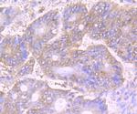 VPS35 Antibody in Immunohistochemistry (Paraffin) (IHC (P))