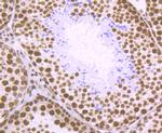 SFPQ Antibody in Immunohistochemistry (Paraffin) (IHC (P))