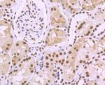 SFPQ Antibody in Immunohistochemistry (Paraffin) (IHC (P))