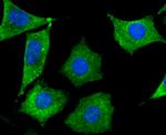 SEPT2 Antibody in Immunocytochemistry (ICC/IF)