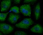 SEPT2 Antibody in Immunocytochemistry (ICC/IF)