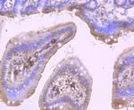 DDX6 Antibody in Immunohistochemistry (Paraffin) (IHC (P))