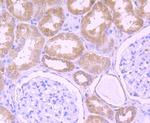 DDX6 Antibody in Immunohistochemistry (Paraffin) (IHC (P))