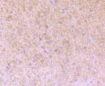 Versican Antibody in Immunohistochemistry (Paraffin) (IHC (P))