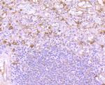 Versican Antibody in Immunohistochemistry (Paraffin) (IHC (P))