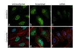 SMARCC1 Antibody