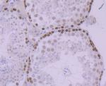 MCM5 Antibody in Immunohistochemistry (Paraffin) (IHC (P))