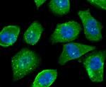 OGT Antibody in Immunocytochemistry (ICC/IF)