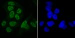 SET Antibody in Immunocytochemistry (ICC/IF)