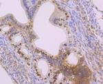 SET Antibody in Immunohistochemistry (Paraffin) (IHC (P))