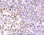 SET Antibody in Immunohistochemistry (Paraffin) (IHC (P))