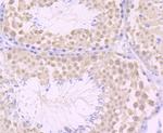 JAB1 Antibody in Immunohistochemistry (Paraffin) (IHC (P))