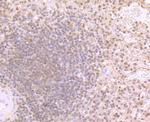 PSMB9 Antibody in Immunohistochemistry (Paraffin) (IHC (P))