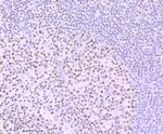 IKAROS Antibody in Immunohistochemistry (Paraffin) (IHC (P))