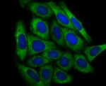 DCP1A Antibody in Immunocytochemistry (ICC/IF)