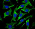 DCP1A Antibody in Immunocytochemistry (ICC/IF)