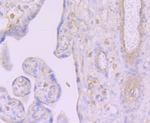 DCP1A Antibody in Immunohistochemistry (Paraffin) (IHC (P))