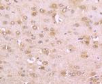 Phospho-alpha Synuclein (Ser129) Antibody in Immunohistochemistry (Paraffin) (IHC (P))