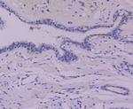 p53 Antibody in Immunohistochemistry (Paraffin) (IHC (P))