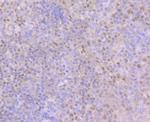 BCL11A Antibody in Immunohistochemistry (Paraffin) (IHC (P))