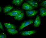 Gelsolin Antibody in Immunocytochemistry (ICC/IF)