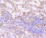 Gelsolin Antibody in Immunohistochemistry (Paraffin) (IHC (P))