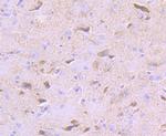 PDK2 Antibody in Immunohistochemistry (Paraffin) (IHC (P))